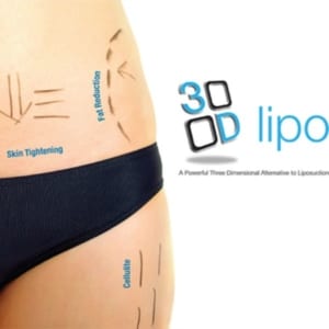 body_tweakments_3d_lipo