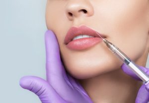 lip filler, lip filler treatment