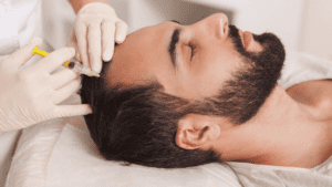 best hair growth treatment for men