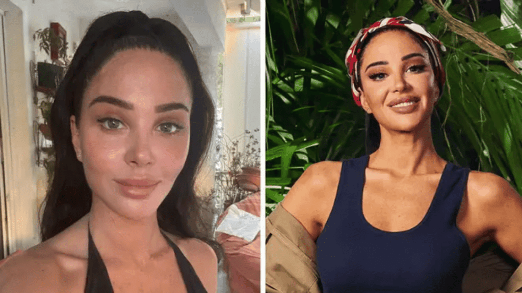 How Injectables helped Tulisa with Bells Palsy