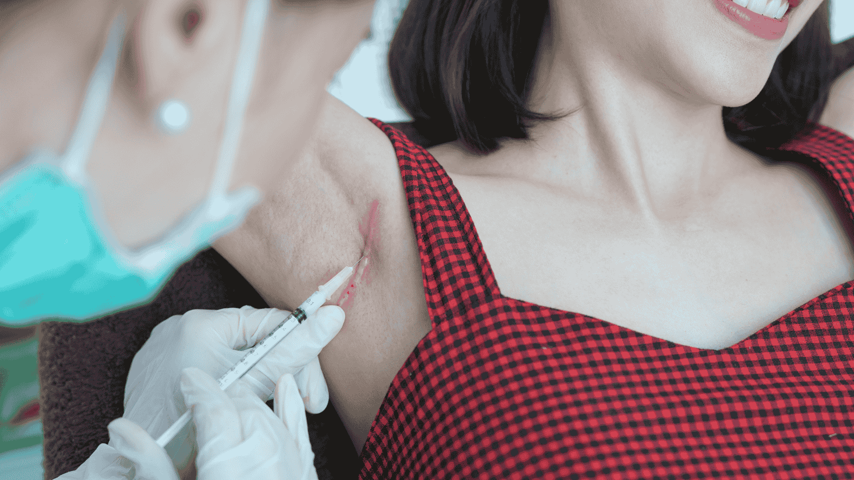 keloid scar treatment