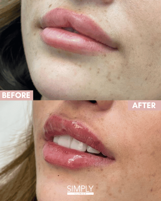 dissolving simply clinics
