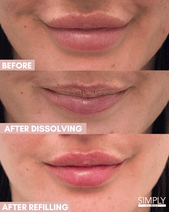 dissolving simply clinics