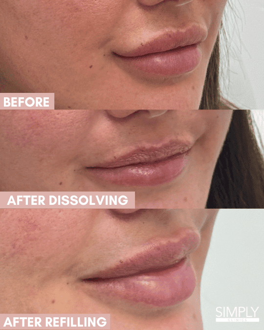 dissolving simply clinics